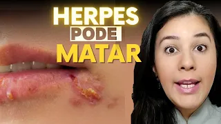 HERPES: DIFERENÇAS entre herpes labial, herpes genital e herpes-zóster, GRAVIDADE e como se PREVENIR