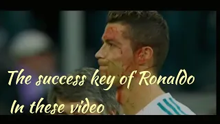 Cristiano Ronaldo✓ Top 5 Horror Injuries ever in Career| HD