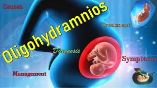 Oligohydramnios: Causes, Pathophysiology, Symptoms, Diagnosis, Complications and Treatment