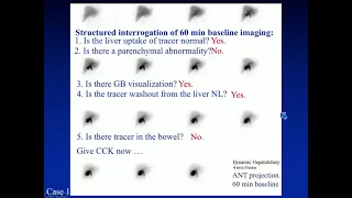 Hepatobiliary Scintigraphy in Chronic Abdominal Pain by Mark Tulchinsky, M.D., FACNM