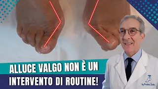 ALLUCE VALGO NON È ROUTINE! | ALLUCE VALGO PERCUTANEA SI O NO? | Dott. Andrea Scala