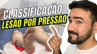 CLASSIFICAÇÃO DA LESÃO POR PRESSÃO - AULA COMPLETA