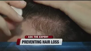 Is there any way to slow down or prevent hair loss?