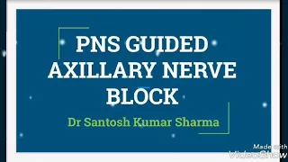 PNS GUIDED AXILLARY BLOCK (CASE OF SEVERE AORTIC STENOSIS)