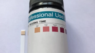 How to read ketone test strip results. What are normal ketone levels ?