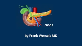 Staging Pancreatic Cancer - case 1