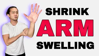 Lymphedema | How to Shrink Swollen Arm