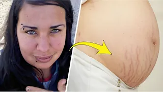 O que saiu da BARRIGA DESSA ADOLESCENTE deixou todos ESPANTADOS 😲😱