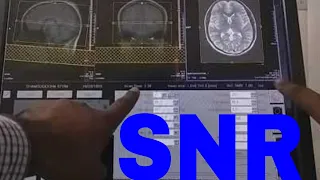 WHAT IS SNR, AVERAGES IN MRI MRI PARAMETERS, WHAT IS MRI