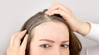 Почему болят корни волос на макушке при прикосновении, когда голова грязная у женщин, у мужчин