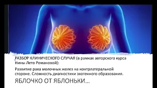 ЯБЛОЧКО ОТ ЯБЛОНЬКИ...