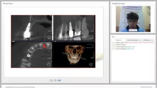 2015 09 15 Лучевая диагностика в дентальной имплантологии