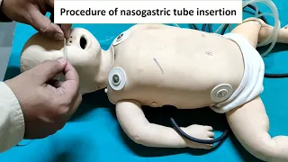 Nasogastric feeding Tube insertion | Ryles Tube | Pediatrics Instruments