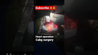 Heart operation |heartattack |open heart surgery | #cardiology #medicalnotes