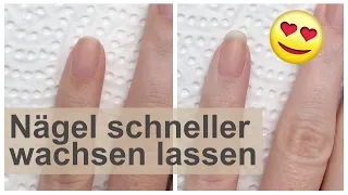 Fingernägel schneller wachsen lassen | 'seni Nageldesign