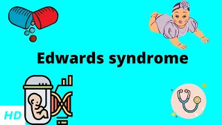 Edwards Syndrome, Causes, Signs and Symptoms, Diagnosis and Treatment.