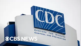 Rare human case of bird flu detected in U.S.; CDC says public risk is low