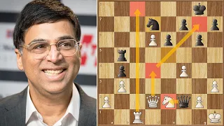 Anand Masterclass