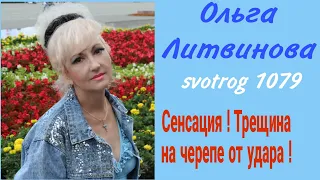 Перевал Дятлова. Ольга Литвинова. Трещина на черепе Семена Золотарёва от удара.