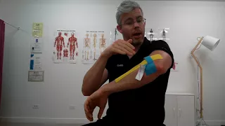 K Taping for Tennis Elbow