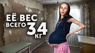 ЕЁ ВЕС ВСЕГО 34 КГ И ОНА РОДИЛА ЧЕТВЕРЫХ...