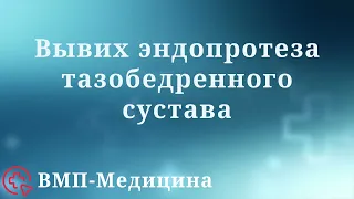 Вывих эндопротеза тазобедренного сустава | ВМП-Медицина