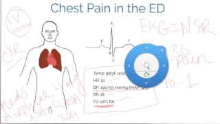 Time Management in the ED and ICU (chest pain patient)