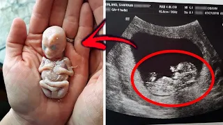 10 Most BIZARRE Babies That Were Born Different