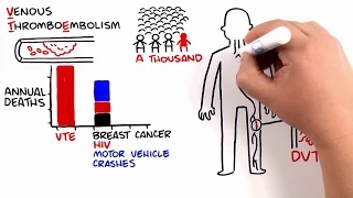 Inherited Thrombophilia: Genetics, Prevalence, Testing Guidelines