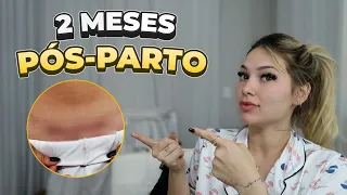 MOSTREI MINHA CICATRIZ PÓS-PARTO!!