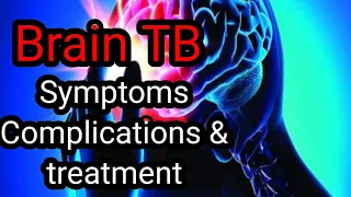 Brain TB Symptoms Complications & treatment. Tuberculosis meningitis. Colours of life.