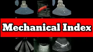 Mechanical Index Ultrasound Physics