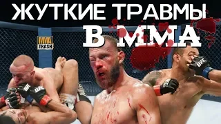 ЖУТКИЕ ТРАВМЫ В ММА! "ЛОМАЙ МЕНЯ ПОЛНОСТЬЮ" / ВЫПУСК ОТ MMATRASH