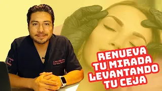 ¿Cejas caídas? ¡La Pexia de Cejas puede ayudarte!