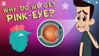 What Causes Conjunctivitis? | CONJUNCTIVITIS | Pink-Eye | The Dr Binocs Show | Peekaboo Kidz