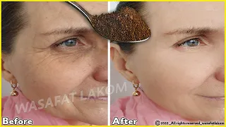 Even if you are 70 years, apply it to wrinkles it will make your face taut like glass.Stronger botox