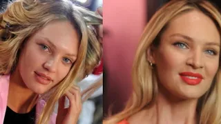 Candice Swanepoel Transformation Young To Now(2019)|| Plastic Surgery