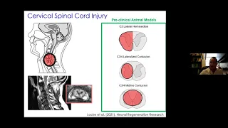 Neural Cell Transplantation to Treat the Injured Cervical Spinal Cord