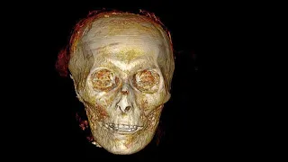 Mummy of Egyptian pharaoh, Amenhotep I digitally unwrapped