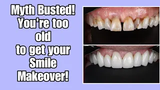 Myth Busted! You’re too old to get your smile makeover!