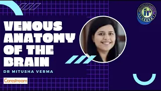 VENOUS ANATOMY OF THE BRAIN | DR MITUSHA VERMA | CAVERNOUS SINUS THROMBOSIS | RADIOANATOMY BRAIN