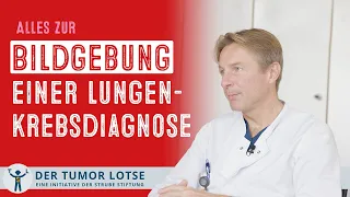 Diagnose Lungenkrebs: welche Bildgebung wird gemacht?