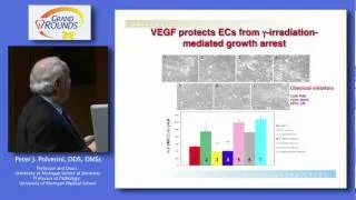 The Unfolded Protein Response in Tumor Growth and Angiogenesis: A Novel Target in Cancer Therapy