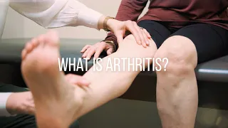 Knee Arthritis Causes, Symptoms, and Treatment