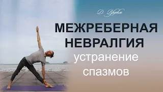 Межреберная невралгия