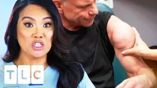 Man With Huge Lipoma Almost Can't Go Through With Operation | Dr. Pimple Popper