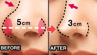 8mins Get Slim, Sharp, Beautiful Nose with This Massage! | Slim Down, Reshape Your Fat Nose