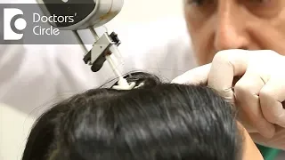 What is the role of Mesotherapy in hair loss? - Dr. K Prapanna Arya