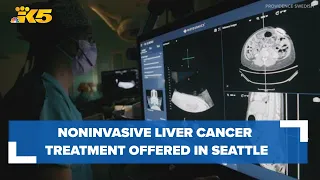 Noninvasive liver cancer treatment now offered in Seattle's First Hill: HealthLink