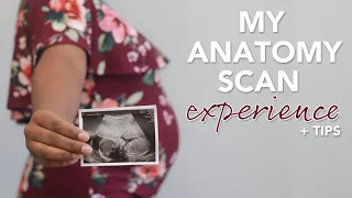 20 Week Anatomy Scan: What to Expect + Tips